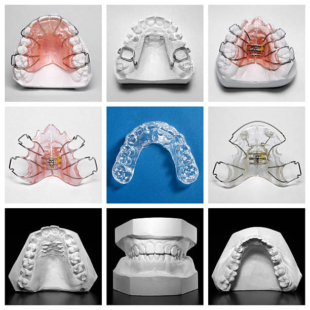 Orthodontic Appliances